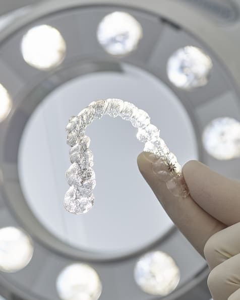 Alignement dentaire by Invisalign